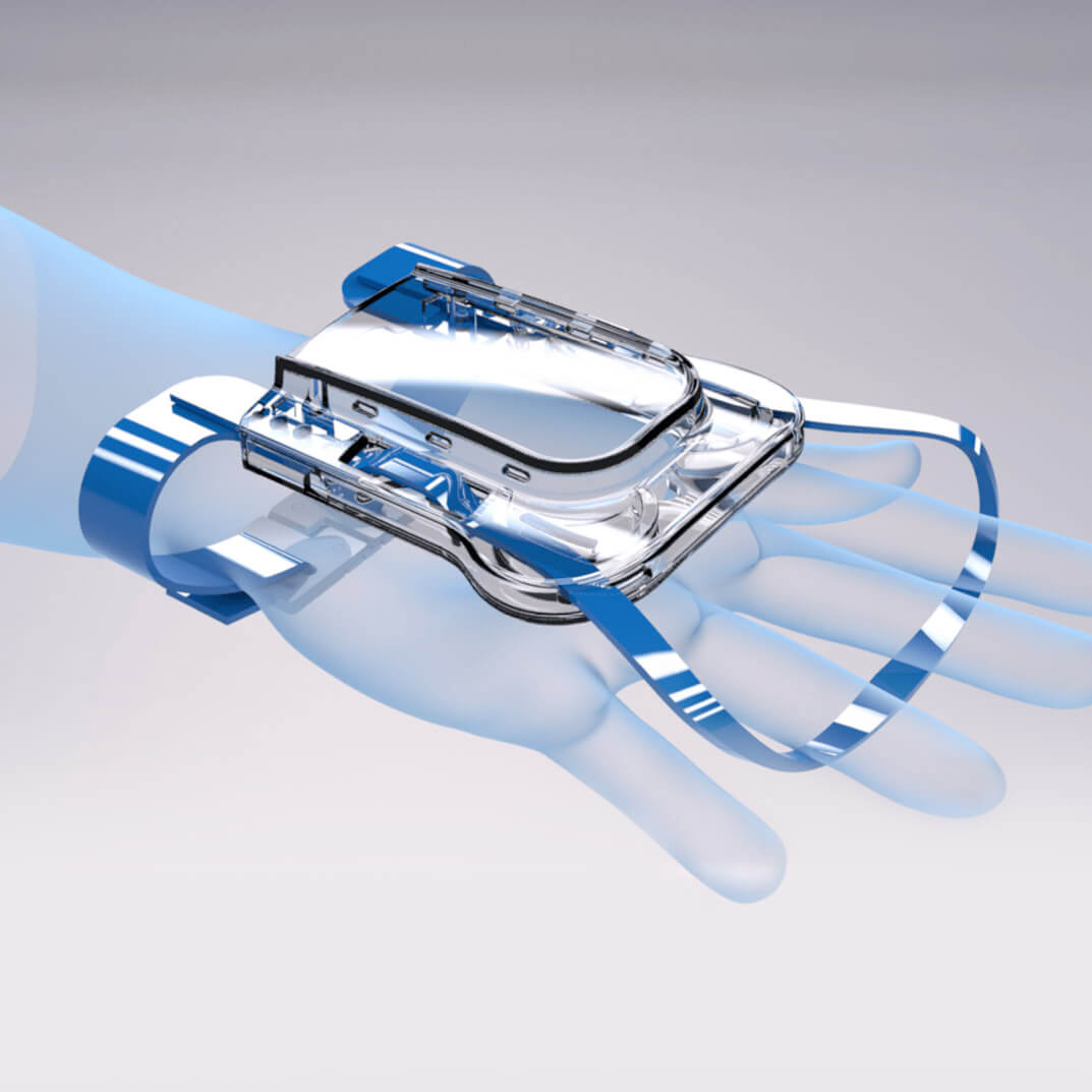 ivglove_hand_sq_photo