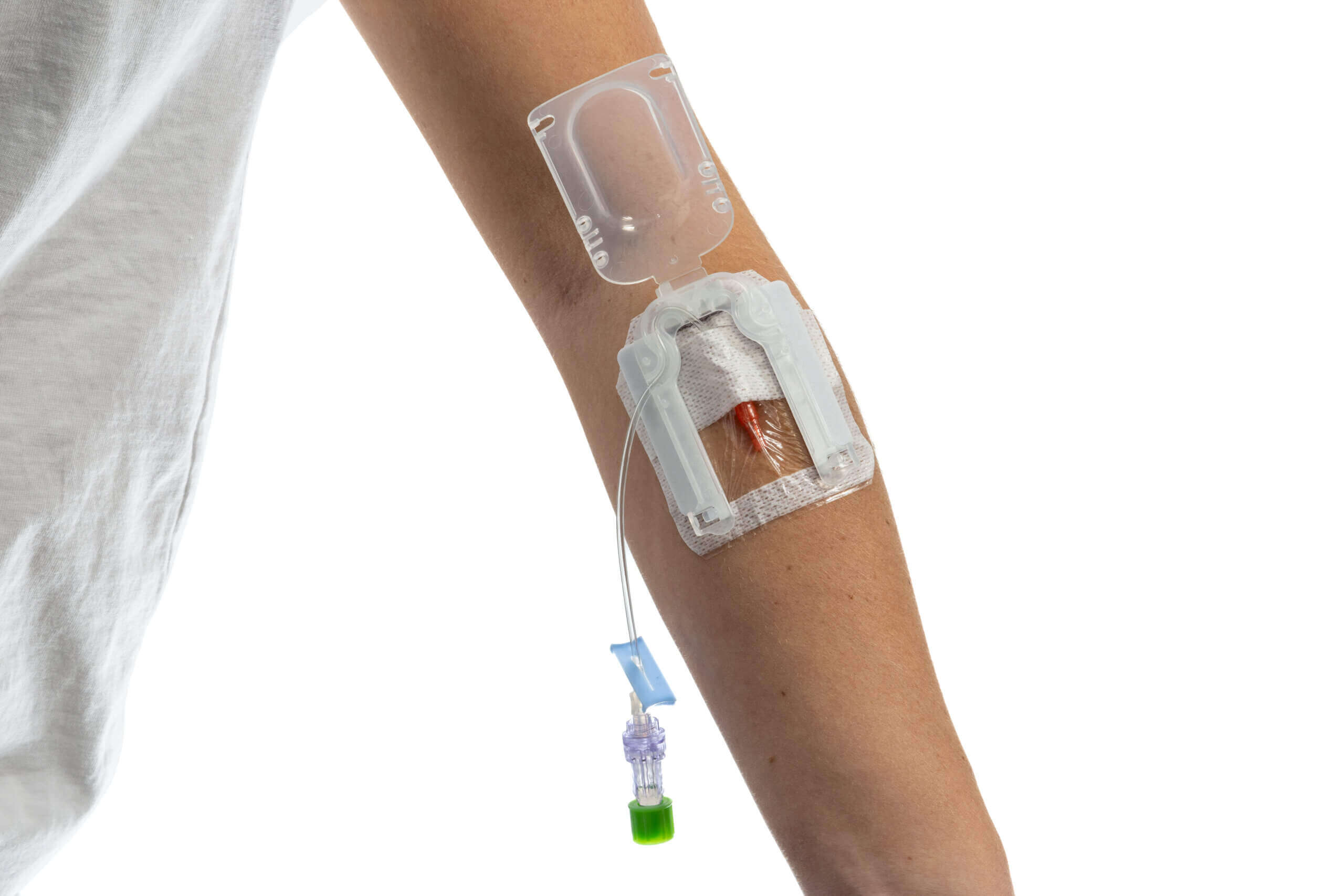 IVglove_EasyStick_Arm_Open_IVGlove-scaled