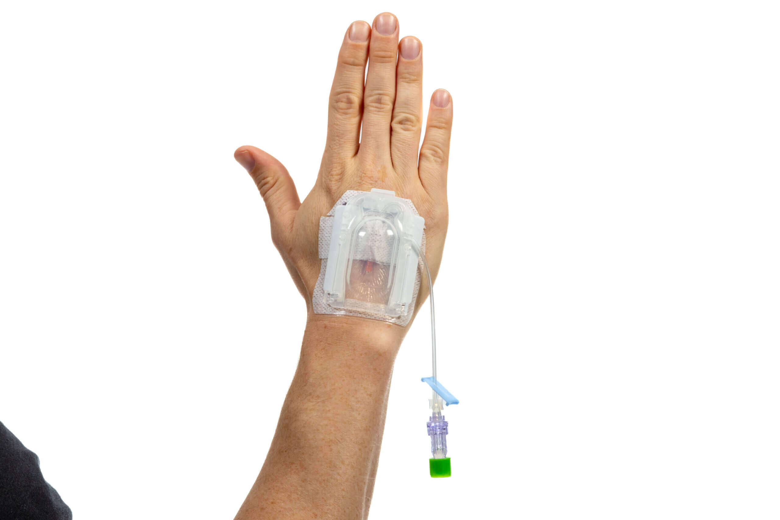 IVglove_EasyStick_Hand_Open_IVGloveOpen-scaled